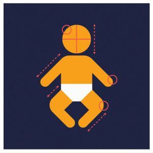 Dysmorphic Features in Children - Learn with OPEN